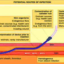 The association's more than 15,000 members. Potential Routes Of Infections Causing Crbsi Download Scientific Diagram