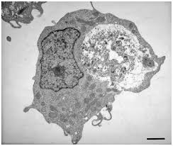 Animal cell transmission electron microscope images. Transmission Electron Microscopy Reveals Distinct Macrophage And Tick Cell Specific Morphological Stages Of Ehrlichia Chaffeensis