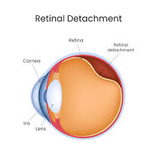 Image result for Retinal Anatomy