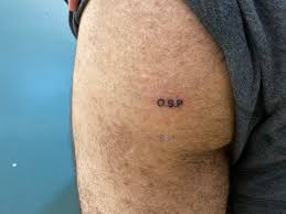 The surgeons place the patient on his or her stomach under. Reddit User Gets Tattoo Of Ovince Saint Preux On Buttocks Sherdog Forums Ufc Mma Boxing Discussion