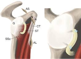 The shoulder joint (glenohumeral joint) is a ball and socket joint between the scapula and the in this article, we shall look at the anatomy of the shoulder joint and its important clinical correlations. Dynamic And Static Stabilization Of Anterior Shoulder Instability With The Subscapular Sling Procedure Arthroscopy Techniques