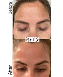 Meg & Co. Medical Aesthetics and Laser