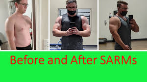 Female bodybuilders are already using sarms to elevate their physique. My Transformation On Sarms Before And After With Pics Rad 140 Lgd 4033 Ostarine Sources Youtube