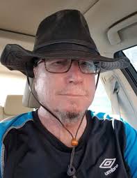 Hi all! I have brain surgery coming up and looking for other brain surgery  survivors to share pics/stories! Specifically lower brain tumors. Mine is  wrapped around my trigeminal nerve.