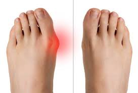 Pin On Health