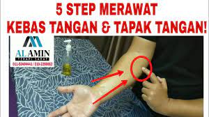 We did not find results for: Urut Kebas Tangan Tapak Tangan Carpal Tunnel Sindrom 011 50404441 Youtube