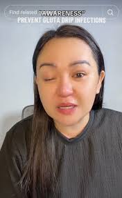 Marian Rivera not yet ready for injectable beauty treatments