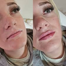 ✨ ABOUT THE FOUNDER Aungelique (aka Ang/ Angie) is a qualified advanced  aesthetic practitioner with a passion for helping people achieve their  personal goals. Ang's previous experience over the years including ventures