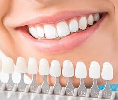 Denture Teeth Color Chart Bedowntowndaytona Com