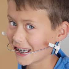 Bryant dental has collected 118 reviews with an average score of 4.98. Types Of Appliances Greater Madison Orthodontics