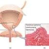 View urinaria.docx from aa 1makalah sistem urinary disusun oleh : 1