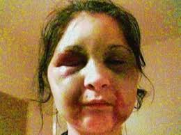 Woman held captive pleads: Help domestic abuse victims