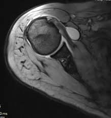 If patients have not hit their deductible, that money comes straight. Shoulder Scan Interpretation Activate Clinic
