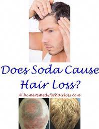 Pin On Thinning Hair No More