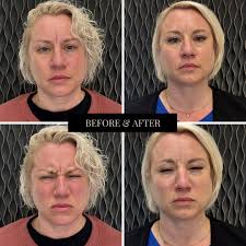 Meet Becky Powers, co-owner of Lively Integrated Health and a  board-certified Family Nurse Practitioner. With a passion for guiding  individuals towards their weight loss goals and hormonal balance, Becky  takes a holistic