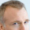 Laser hair therapy is an advanced technology that's safe, effective and easy to use at home. Hair Loss Laser Treatment Protein Changes Point To Mechanism 2019 Wiley Analytical Science