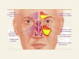 Incepe in tampla apoi ma doare ochiul si urechea. O Durere De Cap AscuÈ›itÄƒ In Partea DreaptÄƒ Principalele Metode De Diagnostic Care Este Natura Durerii Tale