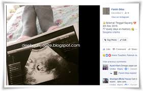 Abortus spontaneous di trimester pertama paling umum terjadi membatasi asupan kafein per hari. Keguguran Apa Yang Perlu Kamu Tahu Deebpunyecite