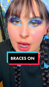 braces #braceson #bracestiktok #spacers #expander #orthodontistsoftik...