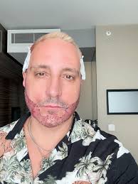 Why would anyone want to imitate a scamming con artist? The dream is real  you just can't deliver it when you steal people's money and have events