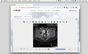 You can also upload dcm files to view my scans in a web browser and view the images. 11 Best Free Online Web Based Cloud Dicom Viewers Services