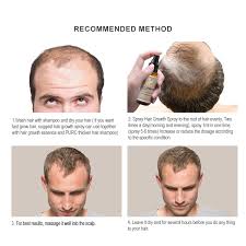 Let us understand the three phases of the hair cycle first. Purc New Product 30ml Hair Care Treatment Hair Growth Spray Ginger Extract Prevent Hair Loss For Men Women Men S Hair Loss Products Aliexpress