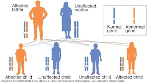 Huntington S Disease Symptoms And Causes Mayo Clinic