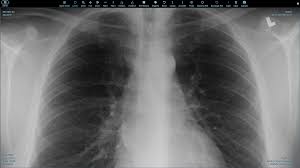 Did you pass a ct (scanner) exam or a mri (magnetic resonance) exam recently? Dicom Viewer Apps App Store Nextcloud