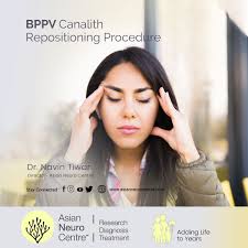 Image result for Canalith Repositioning Procedure