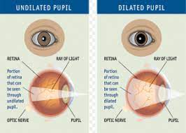Pin On Right Eyes