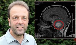 Brain Tumour: Richard Wheatley, 50 was told he had a 'croaky voice' by a  stranger discovers he has tumour
