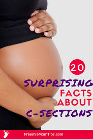 Pin On Pregnancy