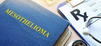 Find out about the symptoms, causes, treatment options and more. Mesothelioma Lawyer Understanding Different Types Of Mesothelioma