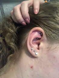 Two Week Old Rook Piercing Is Still Very Sore Is This Normal The Top Of My Ear Behind The Piercing Very Sensitive It S Pierced With A Curved Barbell And I Think Stainless