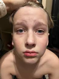 What happened to Isiah's face?