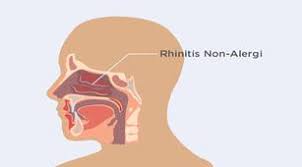 We did not find results for: Penyakit Rhinitis Gejala Penyebab Dan Cara Mengobati Halodoc Com