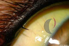 Por Que Se Produce La Ictericia En Perros Y Gatos Puchol