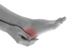 The soleus muscle contributes to pain in the knee, calf, ankle, heel and the low back. What S Causing Your Heel Pain Foot Ankle Associates Of Cleveland