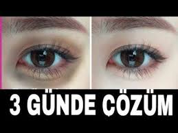 3 Gunde Gozalti Morluklari Kazayaklari Gozalti Torbalarina Dogal Cozum Youtube Gozler Guzellik Dogal