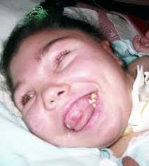 Alea Branson Obituary (1991