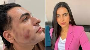 Natália Becker terminou curso de peeling de fenol cinco dias após morte de  jovem