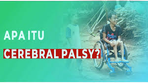 Informasi ini akan bermanfaat bagi setiap orang, terlepas dari apakah ia pernah mengalami pelanggaran semacam itu. Cerebral Palsy Youtube