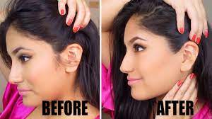 Updated Getting Rid Of Female Sideburns Youtube