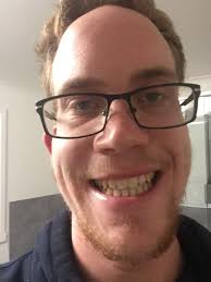 How long should i wear retainers in a day? Teeth Shifted After Braces Reddit Teethwalls