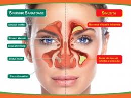 Cel puțin, asta promite conducerea stației de epurare din chișinău. Sinusurile Maxilare