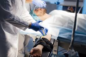 Image result for Anesthesia