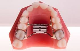 Maybe you would like to learn more about one of these? Greatsydneysmiles