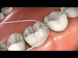 Pin On St Croix Kidds Pediatric Dentistry