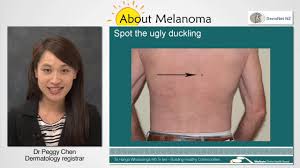 Causes of rash that occur only on the breast may include: Spot The Difference Dermnet Nz