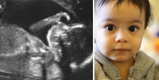 Consciousness science and ethics: Abortion, animal rights, and  vegetative-state debates.